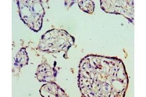 Immunohistochemistry (IHC) image for anti-Signal Transducer and Activator of Transcription 5B (STAT5B) (AA 40-280) antibody (ABIN7169685)