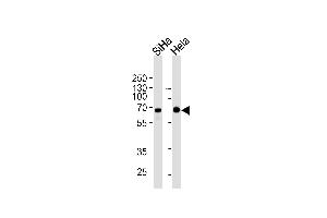 NLK Antibody (ABIN1882269 and ABIN2843492) western blot analysis in SiHa,Hela cell line lysates (35 μg/lane). (Nemo-Like Kinase 抗体)