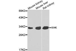Western blot analysis of extracts of various cell lines, using KHK antibody (ABIN5975535) at 1/1000 dilution. (Ketohexokinase 抗体)
