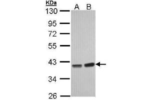 Western Blotting (WB) image for anti-Protein Phosphatase 1, Catalytic Subunit, gamma Isoform (PPP1CC) (Center) antibody (ABIN2856137)