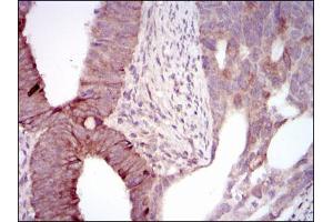 Image no. 3 for anti-Maternal Embryonic Leucine Zipper Kinase (MELK) antibody (ABIN1491623)
