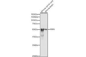 Western blot analysis of extracts of various cell lines, using PRPH antibody (ABIN1682318, ABIN3018463, ABIN3018464 and ABIN6220472) at 1:500 dilution. (Peripherin 抗体  (AA 1-260))