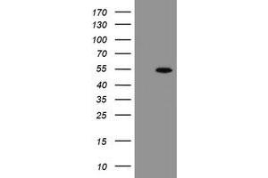 Western Blotting (WB) image for anti-rho GTPase Activating Protein 2 (ARHGAP2) antibody (ABIN1499632)