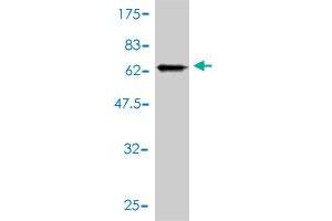 Western Blot detection against Immunogen (67. (GNA13 抗体  (AA 1-377))