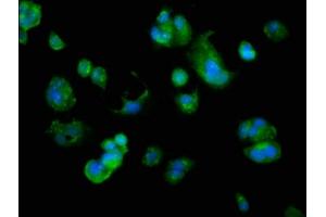 Immunofluorescence staining of MCF-7 cells with ABIN7144607 at 1:166, counter-stained with DAPI. (ARMC1 抗体  (AA 28-160))