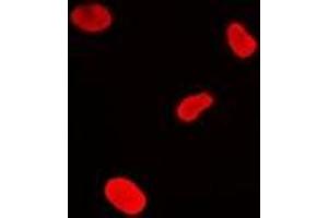 Immunofluorescent analysis of MacroH2A1 staining in U2OS cells. (H2AFY 抗体)