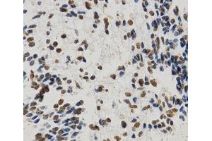 Immunohistochemistry of paraffin-embedded Human embryo brain using MonoMethyl-Histone H3-K9 Polyclonal Antibody at dilution of 1:200 (40x lens).