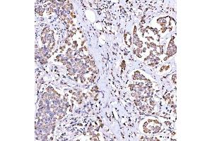 IHC analysis of SUCLG1 using anti-SUCLG1 antibody (ABIN7600906). (SUCLG1 抗体  (AA 25-346))