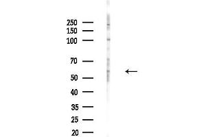 anti-Cysteine-serine-Rich Nuclear Protein 2 (CSRNP2) (Internal Region) antibody