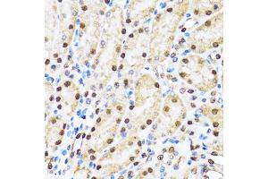 Immunohistochemistry of paraffin-embedded mouse kidney using CCAR2 antibody (ABIN5974285) at dilution of 1/100 (40x lens). (CCAR2 抗体)