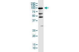 KIAA0226 monoclonal antibody (M03), clone 2G8. (Rubicon 抗体  (AA 1-375))