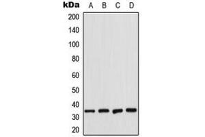 Western blot analysis of CDK2 expression in K562 (A), HeLa (B), NIH3T3 (C), rat heart (D) whole cell lysates. (CDK2 抗体  (Center))
