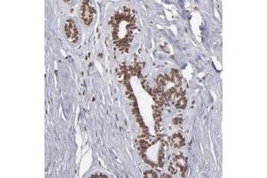 Immunohistochemical staining of human breast with KIAA0020 polyclonal antibody  shows nuclear membranous positivity in glandular cells at 1:50-1:200 dilution. (KIAA0020 抗体)