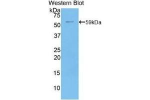 Detection of recombinant CD73 using Polyclonal Antibody to Cluster Of Differentiation 73 (CD73) (CD73 抗体  (AA 29-550))