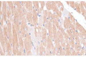 Immunohistochemistry of paraffin-embedded Mouse heart using KATNA1 Polyclonal Antibody at dilution of 1:100 (40x lens). (KATNA1 抗体)