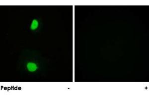 Immunofluorescence analysis of HeLa cells, using KAT5 polyclonal antibody . (KAT5 抗体)