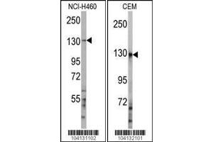 Western blot analysis of anti-UBE4A Antibody in NCI-H460 and CEM cell line lysates (35ug/lane) (UBE4A 抗体  (C-Term))