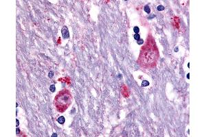 Anti-CHRM3 / M3 antibody IHC of human brain, caudate. (CHRM3 抗体  (Cytoplasmic Domain))