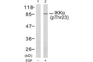 Image no. 2 for anti-conserved Helix-Loop-Helix Ubiquitous Kinase (CHUK) (pThr23) antibody (ABIN196836) (IKK alpha 抗体  (pThr23))