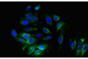 Immunofluorescent analysis of A549 cells using ABIN7143668 at dilution of 1:100 and Alexa Fluor 488-congugated AffiniPure Goat Anti-Rabbit IgG(H+L) (ALDH3B1 抗体  (AA 168-449))
