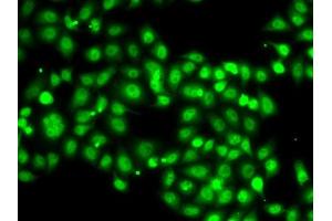 Immunofluorescence analysis of A-549 cells using SETBP1 antibody (ABIN6132919, ABIN6147635, ABIN6147636 and ABIN6223042). (SETBP1 抗体  (AA 1-242))