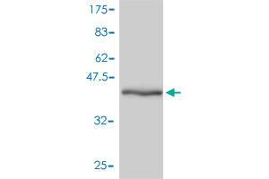 Western Blot detection against Immunogen (42. (GMFB 抗体  (AA 1-154))