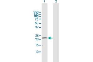 Western Blotting (WB) image for anti-Cytochrome P450, Family 4, Subfamily A, Polypeptide 11 (CYP4A11) (AA 1-215) antibody (ABIN947777)