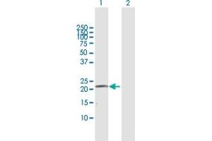 Western Blot analysis of CYP4A11 expression in transfected 293T cell line by CYP4A11 MaxPab polyclonal antibody. (CYP4A11 抗体  (AA 1-215))