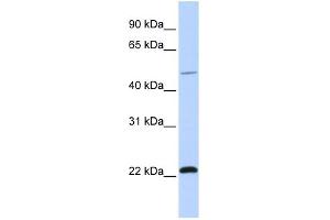 WB Suggested Anti-WWP2 Antibody Titration:  0. (WWP2 抗体  (C-Term))