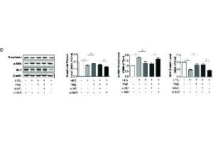 Western Blotting (WB) image for anti-Sirtuin 1 (SIRT1) (AA 448-747) antibody (ABIN6147784)