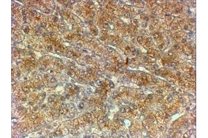 ABIN2613388 (2µg/ml) staining of paraffin embedded Human Liver. (ATG4A 抗体  (Internal Region))