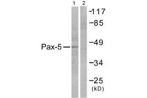 Western Blotting (WB) image for anti-Paired Box 5 (PAX5) (N-Term) antibody (ABIN1848733) (PAX5 抗体  (N-Term))