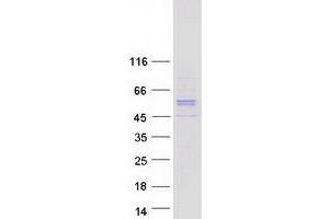 Validation with Western Blot (RGS11 Protein (Transcript Variant 1) (Myc-DYKDDDDK Tag))