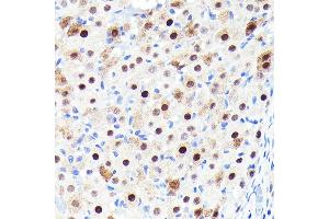 Immunohistochemistry of paraffin-embedded rat ovary using CDKN1B/p27KIP1 Rabbit mAb (ABIN7266602) at dilution of 1:100 (40x lens). (CDKN1B 抗体)