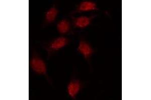 ABIN6275939 staining MCF7 by IF/ICC. (OPN3 抗体  (Internal Region))