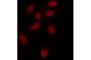 ABIN6275939 staining MCF7 by IF/ICC.