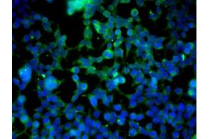 Image provided by One World Lab validation program. (Cadherin 5 抗体  (AA 601-700))