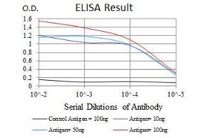 Black line: Control Antigen (100 ng), Purple line: Antigen(10 ng), Blue line: Antigen (50 ng), Red line: Antigen (100 ng), (GSTM1 抗体)
