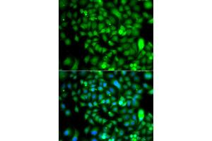 Immunofluorescence analysis of A549 cells using CSRP2BP antibody. (CSRP2BP 抗体)