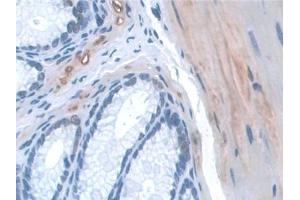 Detection of KIBRA in Mouse Colon Tissue using Polyclonal Antibody to Kidney And Brain Protein (KIBRA)