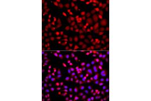 Immunofluorescence analysis of A549 cell using MTUS1 antibody. (MTUS1 抗体)