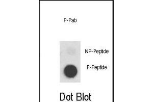 Dot blot analysis of anti-Phospho-MET-p Phospho-specific Pab (ABIN389596 and ABIN2839609) on nitrocellulose membrane.