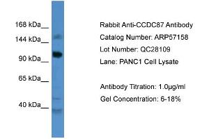 WB Suggested Anti-CCDC87  Antibody Titration: 0. (CCDC87 抗体  (C-Term))