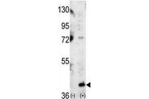 Western Blotting (WB) image for anti-Mitogen-Activated Protein Kinase 14 (MAPK14) (AA 295-324) antibody (ABIN3031831)