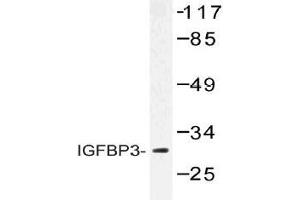 Western blot (WB) analysis of IGFBP3 antibody in extracts from HUVEC cells. (IGFBP3 抗体)