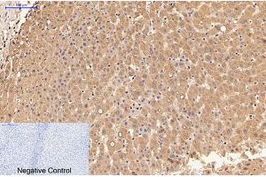 Immunohistochemical analysis of paraffin-embedded human liver tissue. (LALBA 抗体)