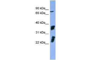 WB Suggested Anti-FGFR2  Antibody Titration: 0. (FGFR2 抗体  (C-Term))