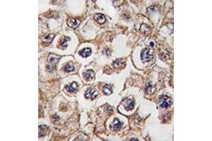 IHC analysis of FFPE human testis tissue stained with Insulin receptor-related antibody (INSRR 抗体  (AA 16-47))