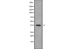 Western blot analysis GFI1B using 293 whole cell lysates (GFI1B 抗体  (Internal Region))