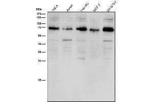 All lanes use the Antibody at 1:1K dilution for 1 hour at room temperature.